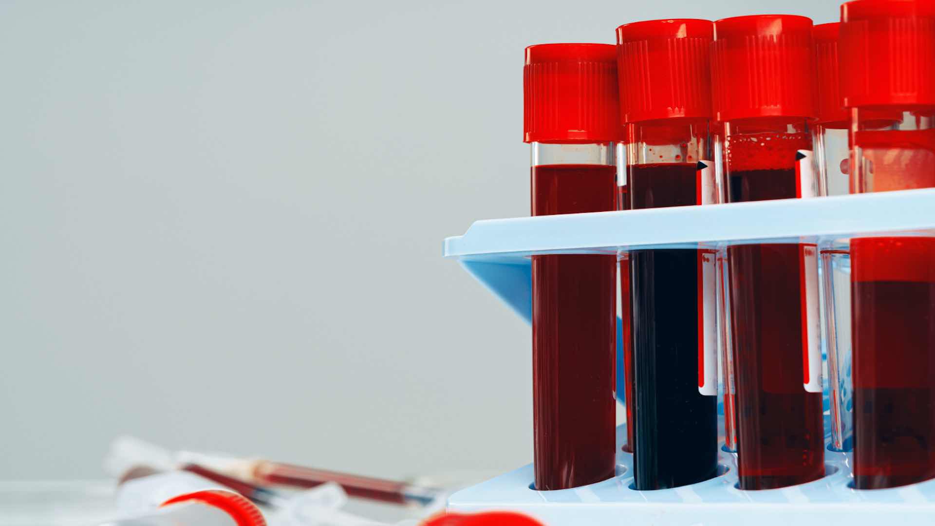 Innovative blood test introduced for cancer care in Abu Dhabi